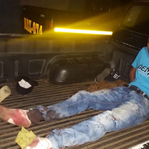 Sujeto detenido por lapidar a una persona