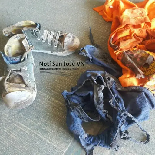 Niño quemado EU Emisoras Unidas Guatemala ,