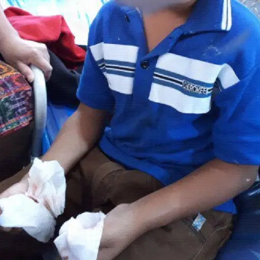 Niños amputados por bombas EU Emisoras Unidas Guatemala ,