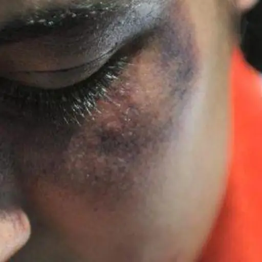 Padrastro golpeaba a hijastra ,