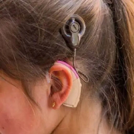 IMPLANTE-1519511275 ,