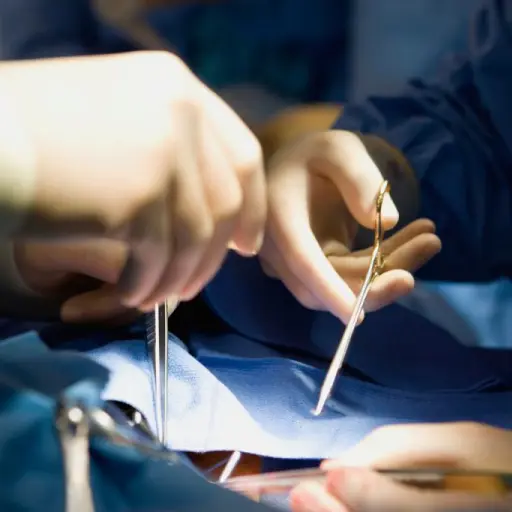 transplantes de organos 1 ,