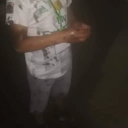 niños afectados por aceite en antorchas ,