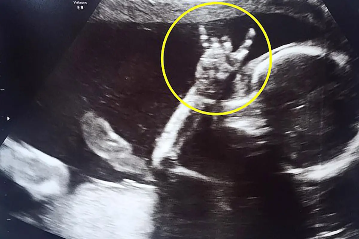 rock-music-baby-ultrasound-sign-horns, 