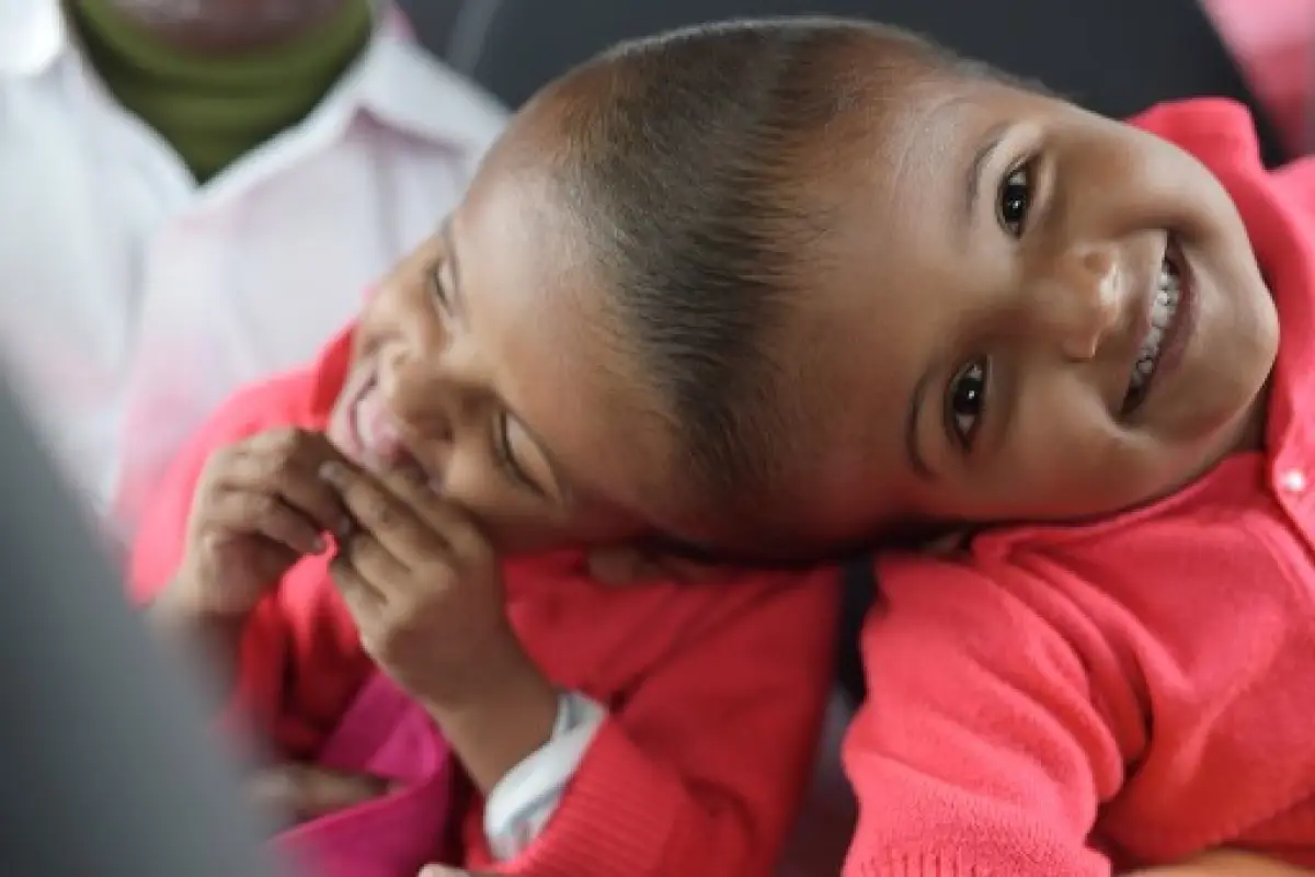 This handout photograph taken on January 5, 2019 and received on August 2 from the Action for Defenceless People Foundation (ADPF) shows conjoined Bangladeshi twins Rabeya and Rukaya during their visit to Budapest, in preparation for their their final sep