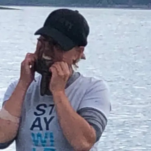 Mujer sufre parálisis facial al colocarse un pulpo en la cara ,