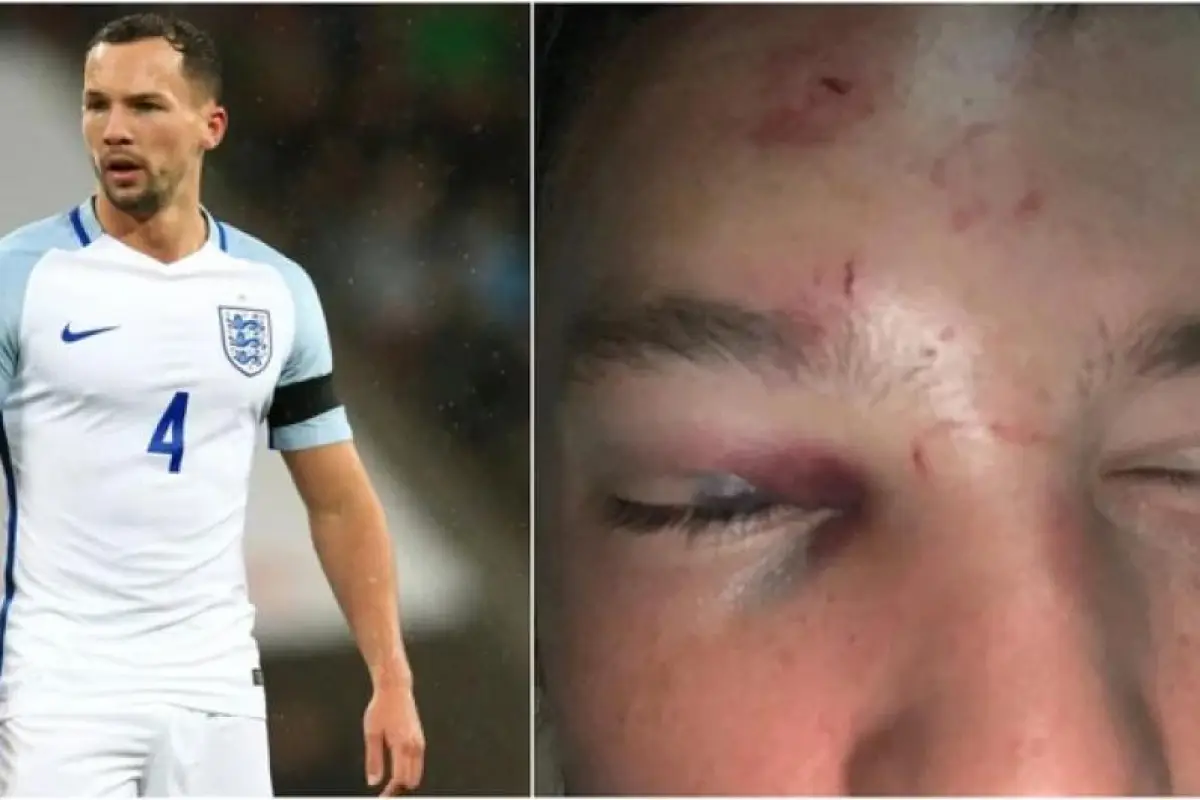 jugador golpeado de la Premier League, 