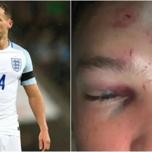 jugador golpeado de la Premier League ,