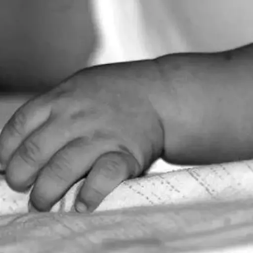 Niño atropellado Mixco