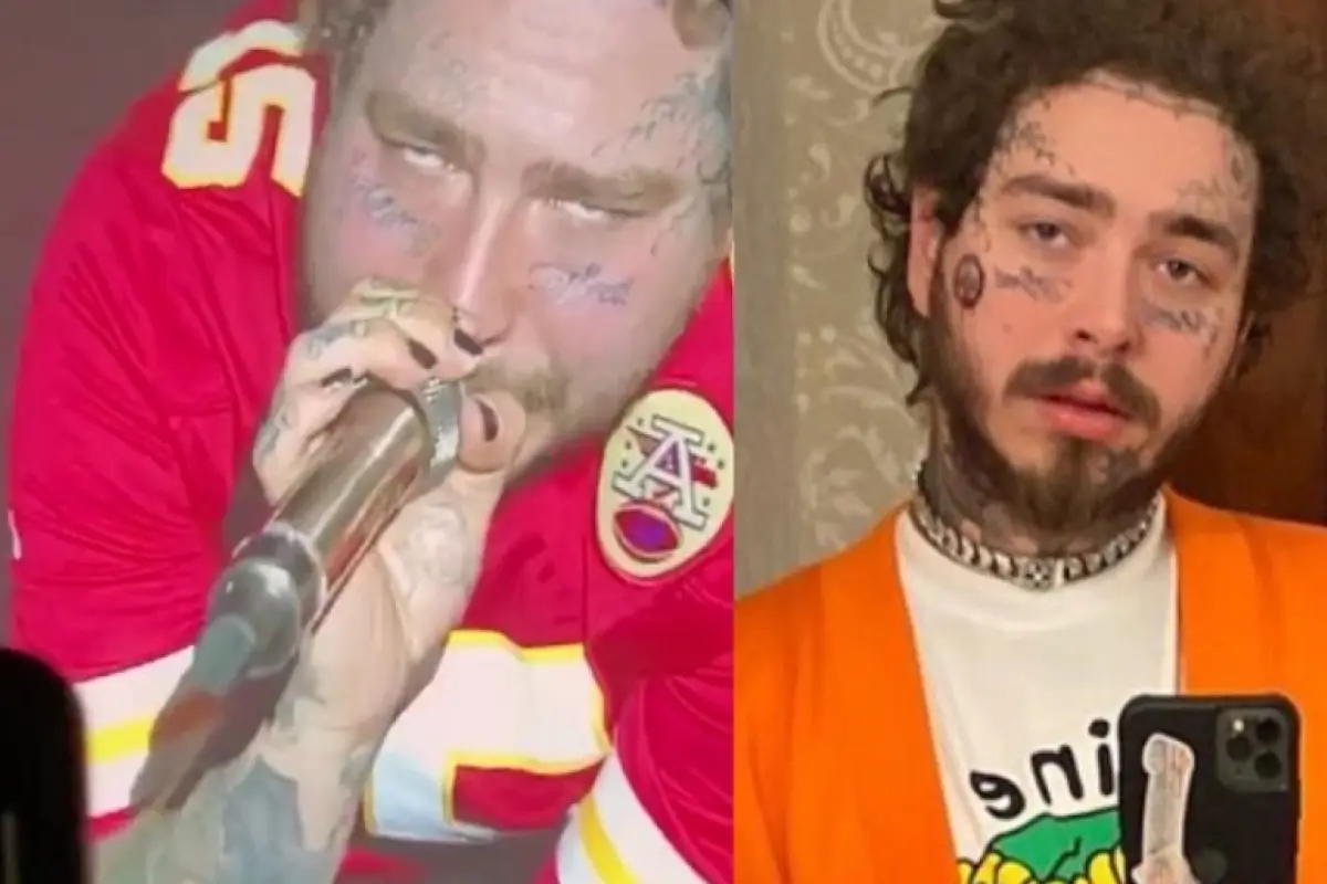 Post Malone exceso de drogasc