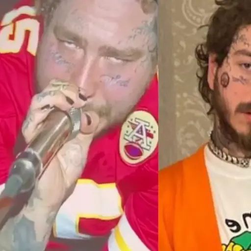 Post Malone exceso de drogasc