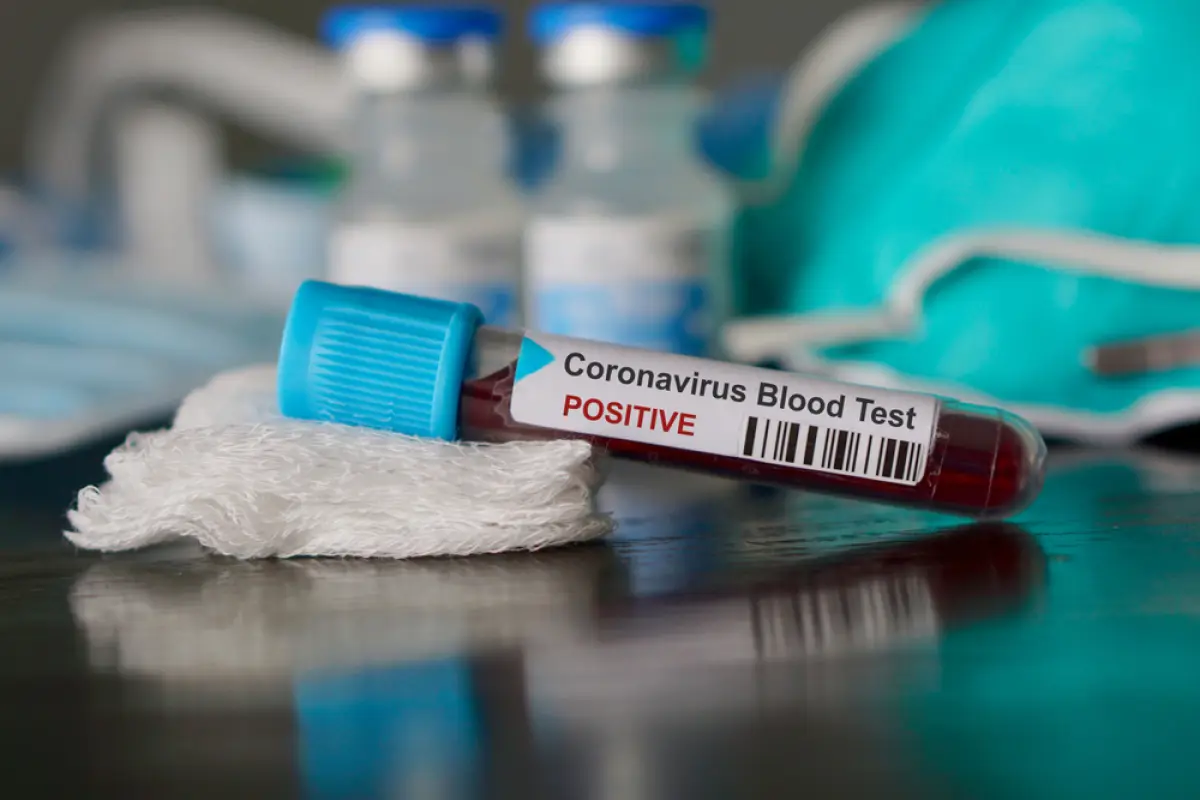 prueba-coronavirus, 