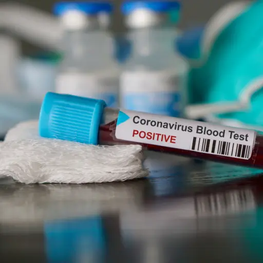 prueba-coronavirus ,