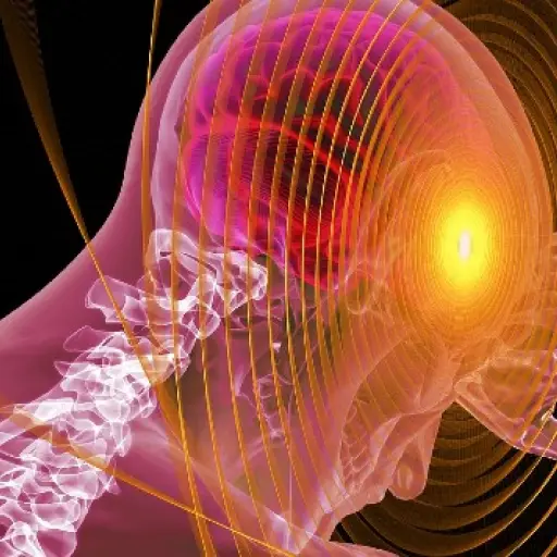 Encephalitis-covid19 ,