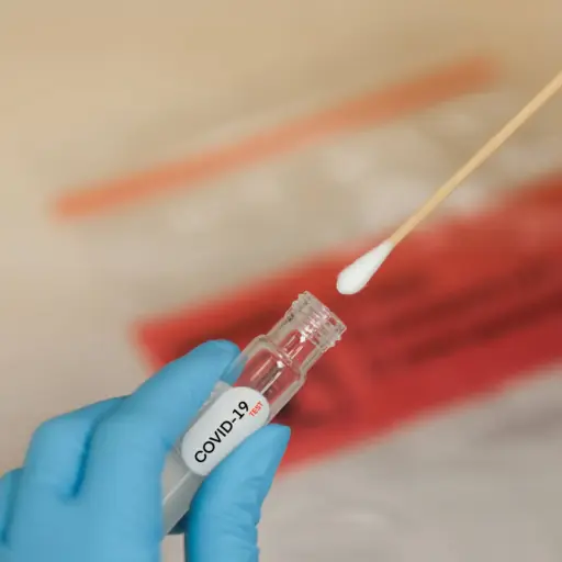 prueba-coronavirus ,