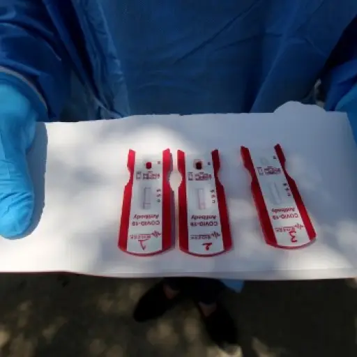 Científicos investigan un anticuerpo que podría combatir el coronavirus