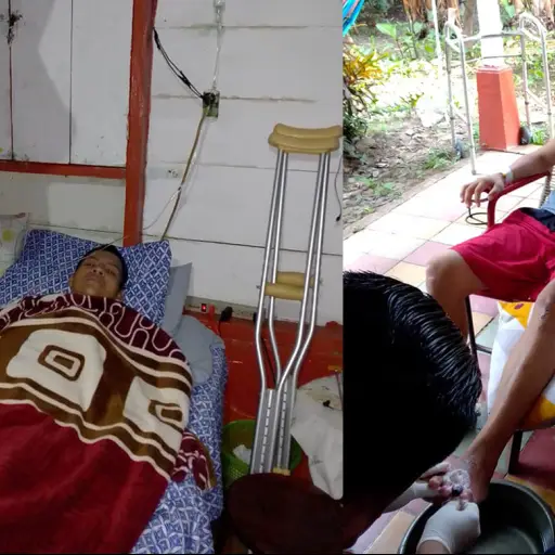 Hombre pie diabetico Retalhuleu Emisoras Unidas Guatemala ,