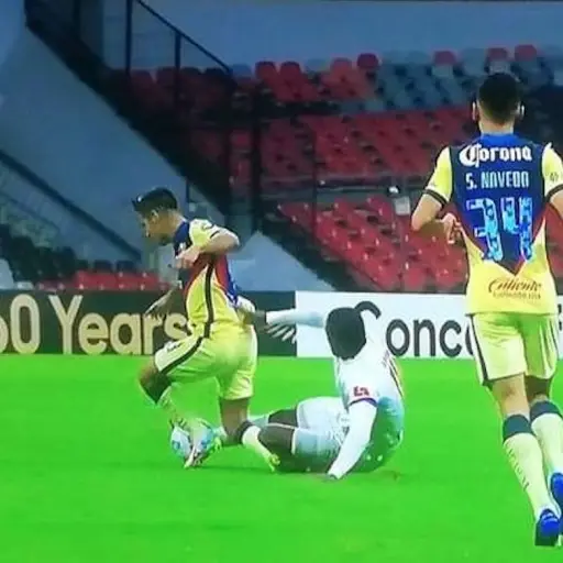 revelan-radiografia-fracturajesus-chucho-lopez-publinews- ,