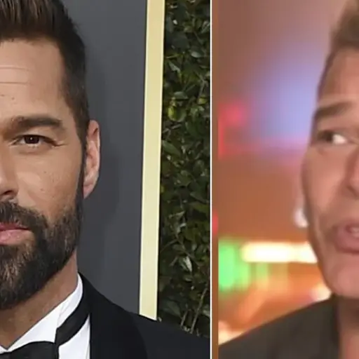 Ricky Martin rostro cirugías estéticas ,