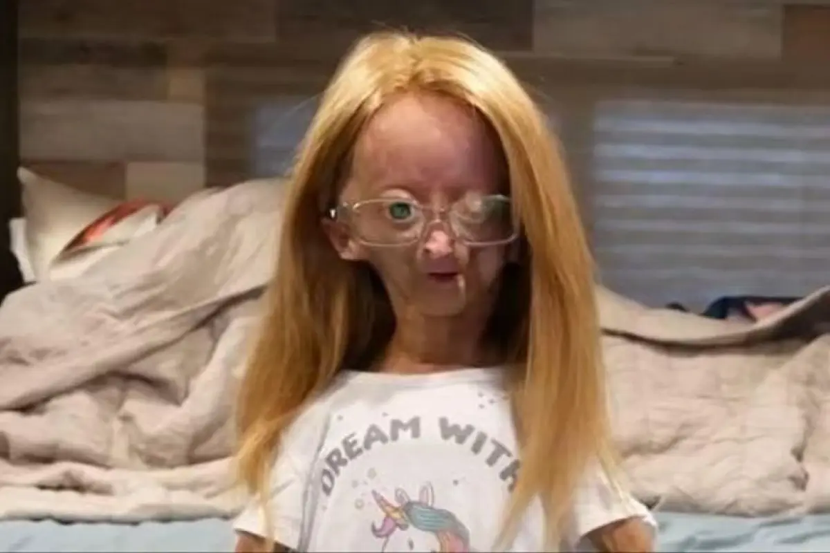 Adalia Rose youtuber, 