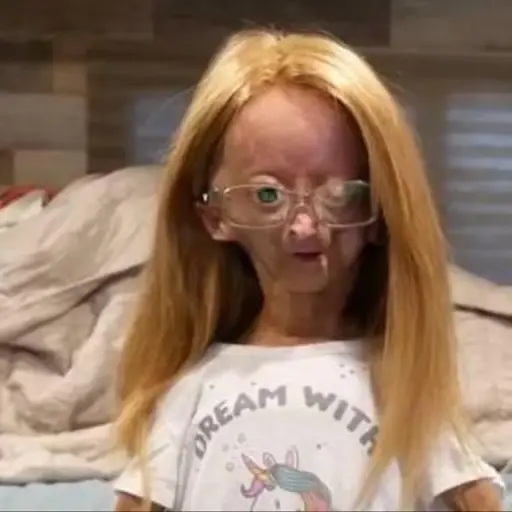 Adalia Rose youtuber ,