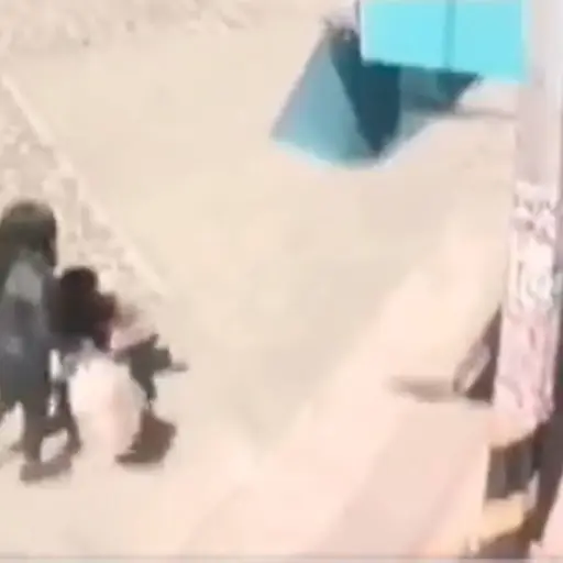 ataque-perro-nina-2-anos ,