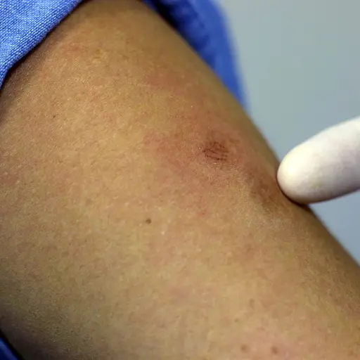 Imagen con fines ilustrativos | pixabay.com