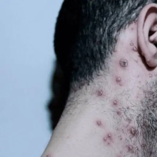 Imagen con fines ilustrativos.