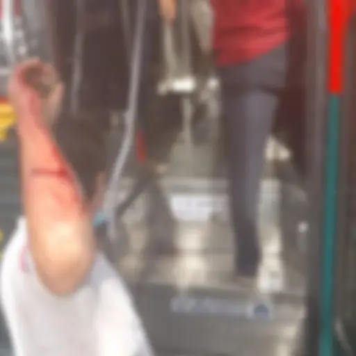 Pilotos de buses extraurbanos heridos tras pelea por pasaje ,