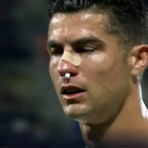 Cristiano Ronaldo golpe nariz ,