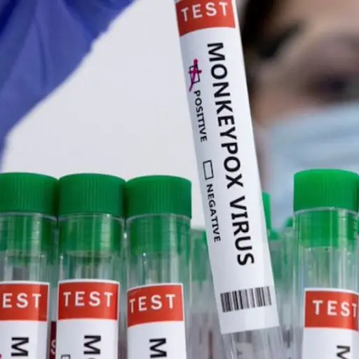 OMS mantiene el nivel de alerta maxima contra la viruela del mono ,