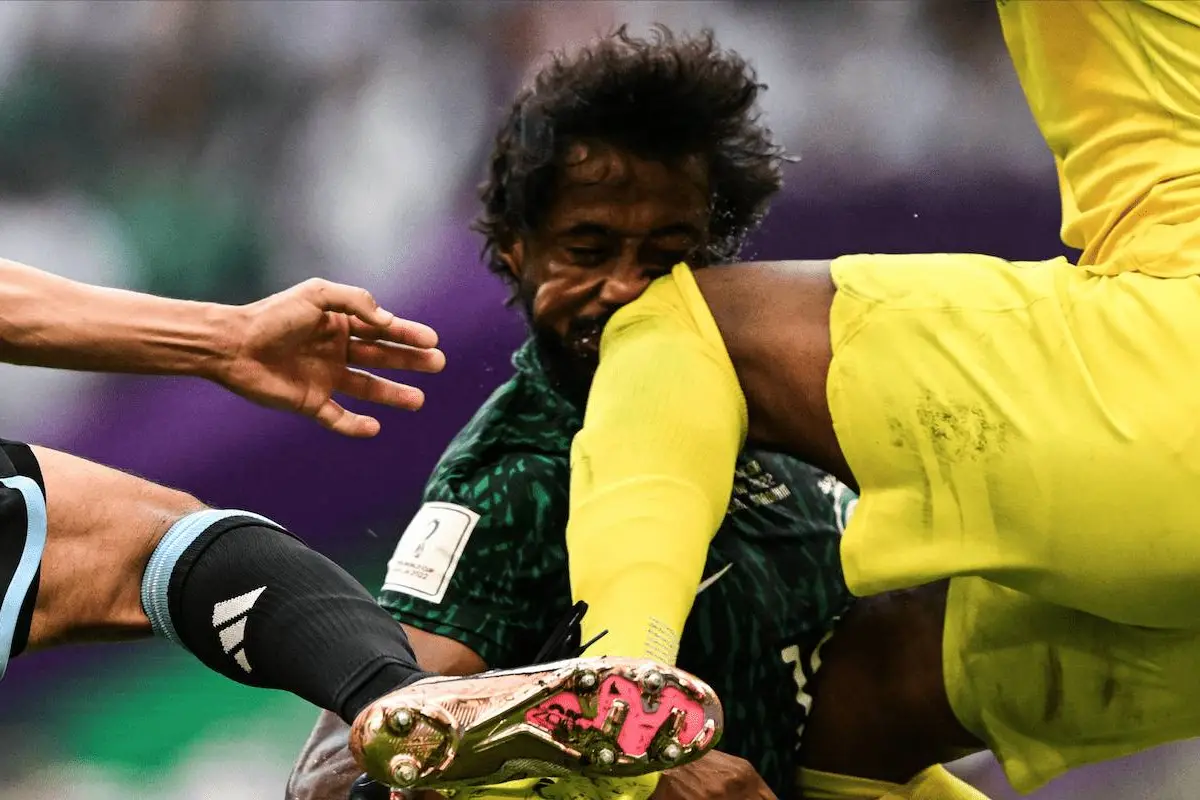 jugador-arabia-saudita-Yasir-Al-Shahrani-se-fractura-publinews-.png, 