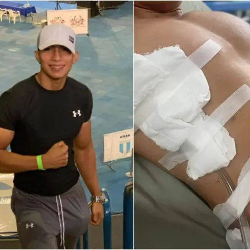 Asaltan y apunalan a reconocido atleta en Retalhuleu ,