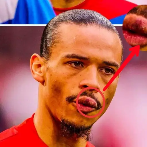 Así quedó el labio de Sané tras el golpe que recibió de Sadio Mané ,