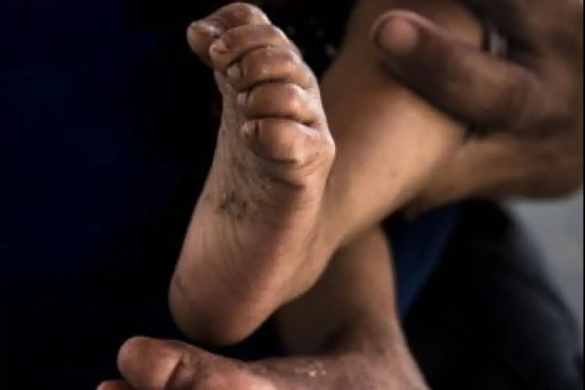 maria-raquel-reportaje-de-desnutricion-y-pobreza-22.jpg,