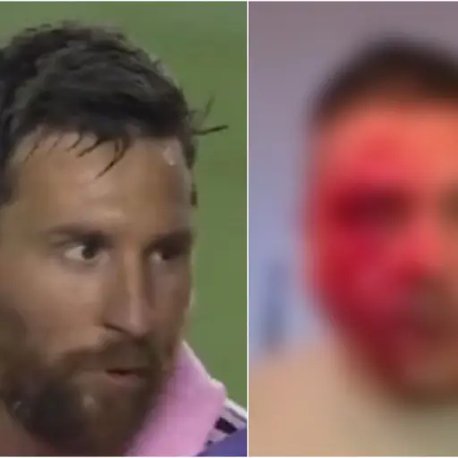 messi-golpiza-comensal-miami ,