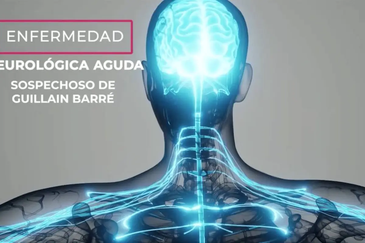 enfermedad-neurologica-aguda-guillian-barre-alerta-poblacional-1, 