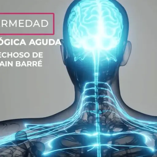 enfermedad-neurologica-aguda-guillian-barre-alerta-poblacional-1 ,