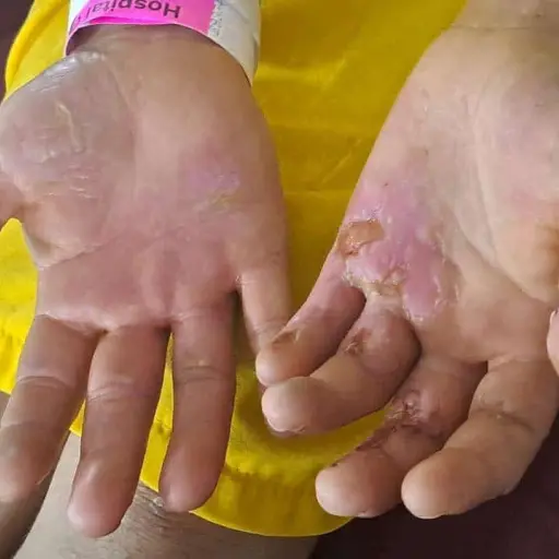 maltrato-mujer-vivienda-mixco-emisoras-unidas ,