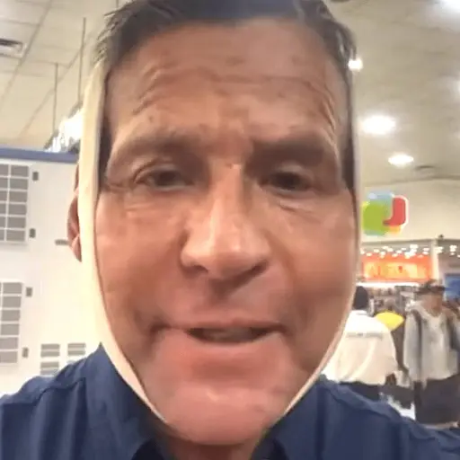 alfredo-adame-vendada-e-hinchada ,