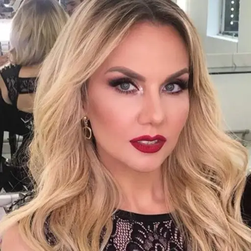 ¿Qué le pasó? Michelle Vieth sorprende al aparecer con el rostro irreconocible  ,Redes sociales