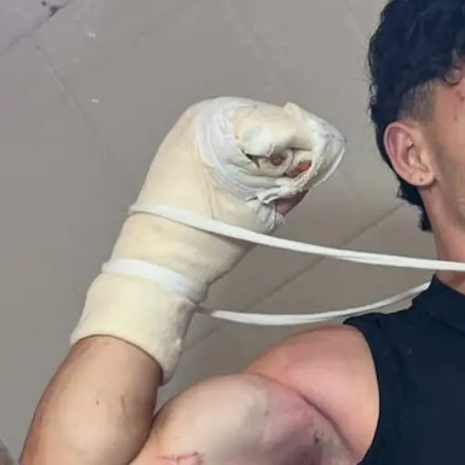 Gero Arias se pronuncia en redes tras su accidente.  ,Instagram/Gero Arias.