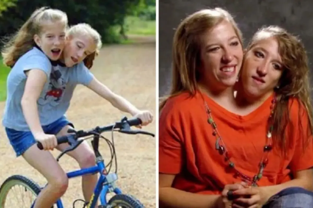 Abby y Brittany Hensel, Redes sociales