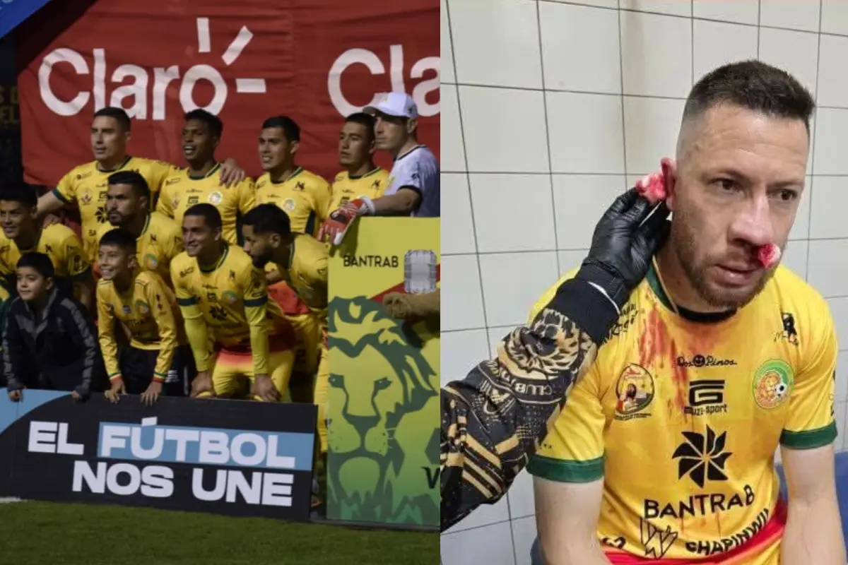 Alexander Cifuentes termina suturado tras clásico del occidente 