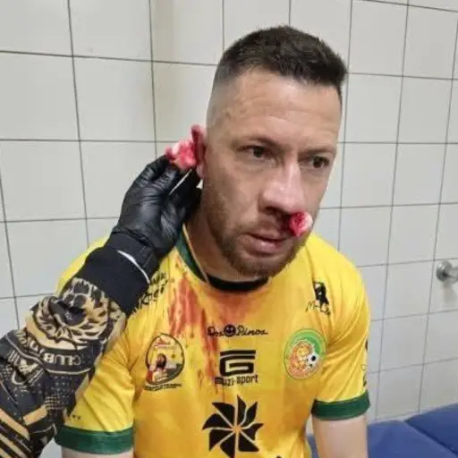 Alexander Cifuentes termina suturado tras clásico del occidente 