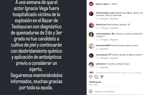 Ignacio Vega, actor mexicano, en estado delicado tras sufrir quemaduras por explosión