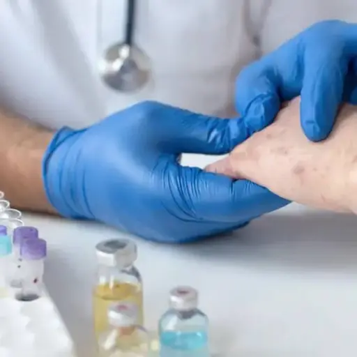 Un paciente evaluado por riesgo de sarampión. ,Ilustrativa de archivo