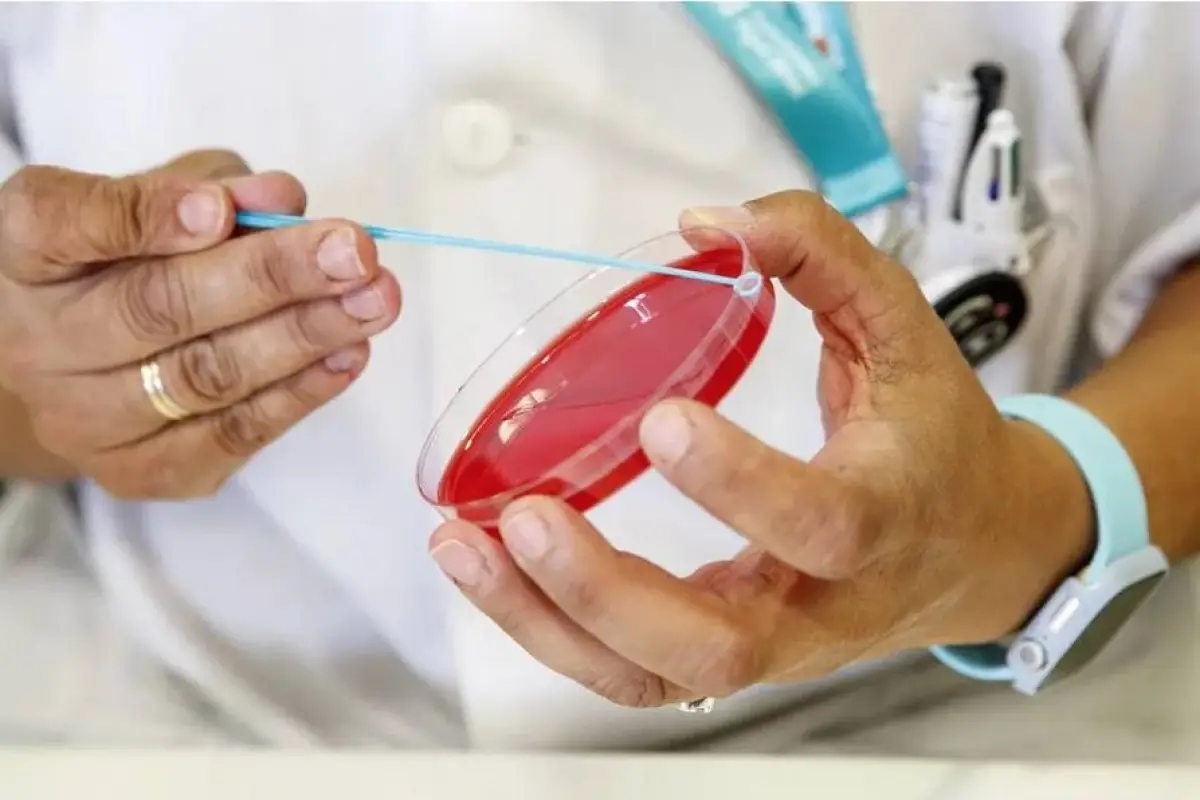 Personal técnico de laboratorio prepara unas muestras para analizar por posible sarampión., Ilustrativa de archivo: EFE