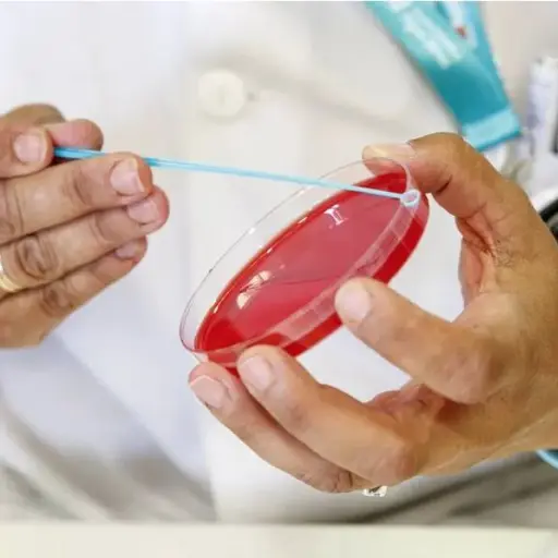 Personal técnico de laboratorio prepara unas muestras para analizar por posible sarampión. ,Ilustrativa de archivo: EFE