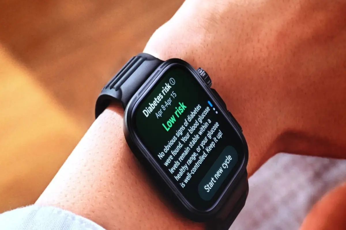 Smartwatch, Smartwatch